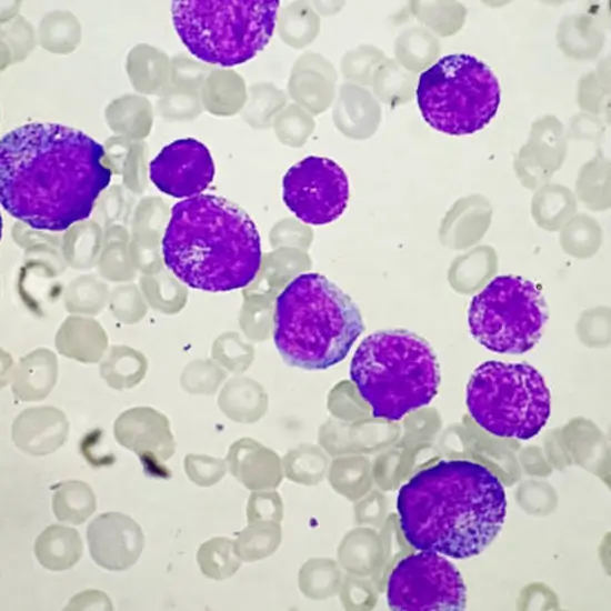 Total Leucocyte Count